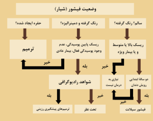 نمودار روش های درمانی پوسیدگی های اکلوزال.